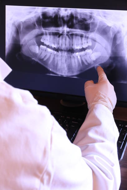 Best Emergency Tooth Extraction in Oglala, SD