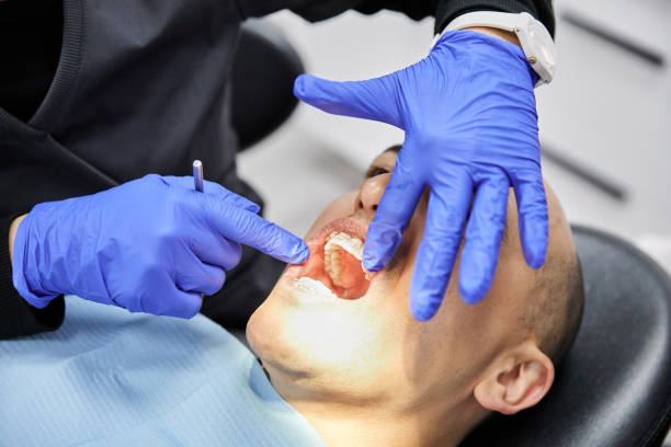 Best Emergency Broken Tooth Repair in Oglala, SD